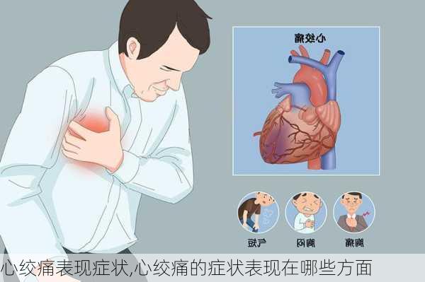 心绞痛表现症状,心绞痛的症状表现在哪些方面